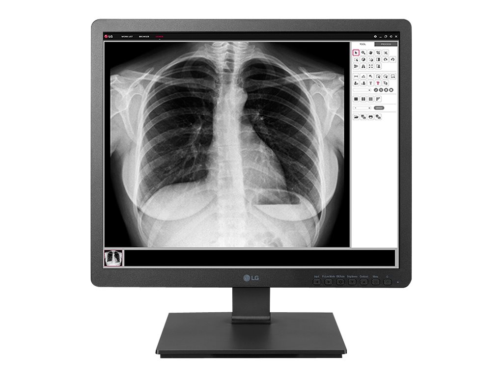 Monitor LG 19HK312C-B 19 IPS - Imagem 2