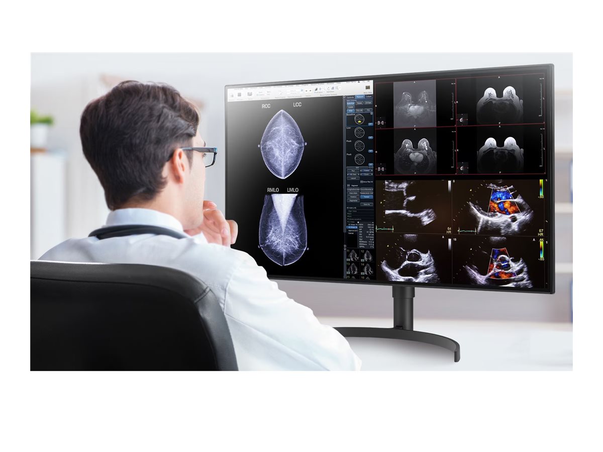 Monitor de Diagnóstico Médico LG 32HL512D-M 31.5" IPS 4K 8MP HDR10 450cd/m² HDMI 2xDP USB 3.0 Preto - Imagem 8