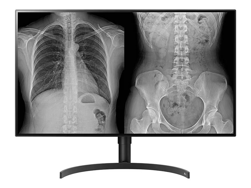 Monitor de Diagnóstico Médico LG 32HL512D-M 31.5" IPS 4K 8MP HDR10 450cd/m² HDMI 2xDP USB 3.0 Preto - Imagem 1